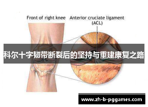 科尔十字韧带断裂后的坚持与重建康复之路